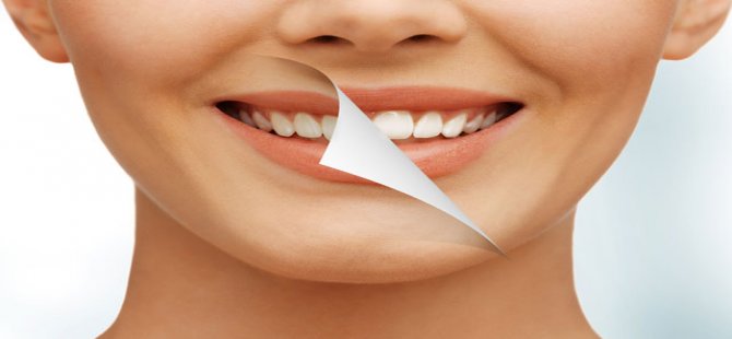 Diş Sağlığıyla İlgili Doğru Sanılan 8 Yanlış