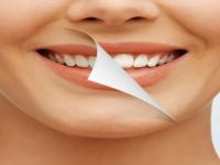 Diş Sağlığıyla İlgili Doğru Sanılan 8 Yanlış